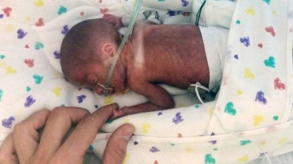 Sept. 11, 2015: In this photo provided by Emily Morgan, Chase Morgan holds his son Haiden's hand at the Miami Children's Hospital. Emily Morgan, who unexpectedly gave birth on a cruise ship months before her due date says she wrapped towels around her boy and, with the help of medical staff, managed to keep him alive until the ship reached port. (Emily Morgan via AP)
